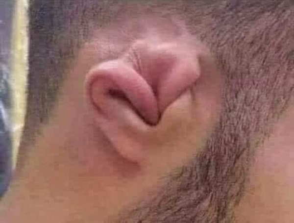 12. Умеете шевелить ушами? А сворачивать их?