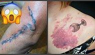 Берем на заметку: Как можно скрыть страшные шрамы при помощи тату