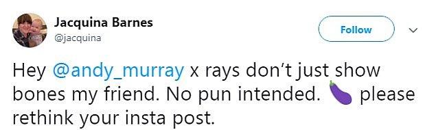 "Hey Andy Murray, röntgenler sadece kemiği göstermez dostum. Alınma ama, Instagram paylaşımını bir daha düşünsen?"