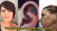 Her Şey Güzellik İçin! Bronz Ten Uğruna Yıllardır Gittiği Solaryum Yüzünden Kulağı Kesilen Kadın