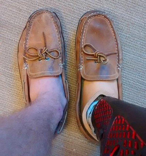 11. "Bir yılın ardından sıradan ayağımdaki ve protez ayağımdaki ayakkabıların farkı."