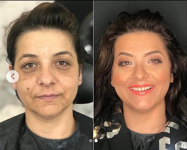 7. Круги под глазами больше не проблема