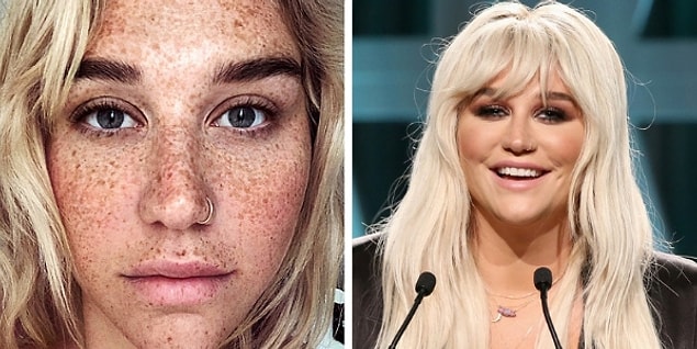1. Kesha