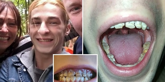 Her Gün 6 Kutu Enerji İçeceği İçerseniz Dişlerinize Olacakları Biliyor musunuz?