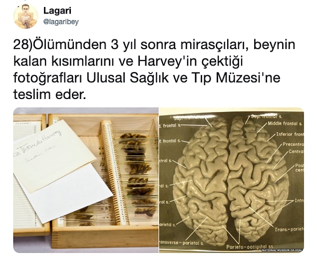 28.