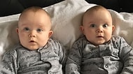 Olmaz Denilen Oldu! Tek Yumurtada Oluşmalarına Rağmen Farklı Cinsiyete Sahip Olan Yarı Özdeş İkizler