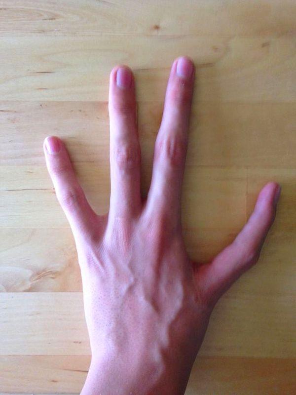 9. "I Have Only Four Fingers On My Left Hand, And Have And Index Finger Instead Of My Thumb"