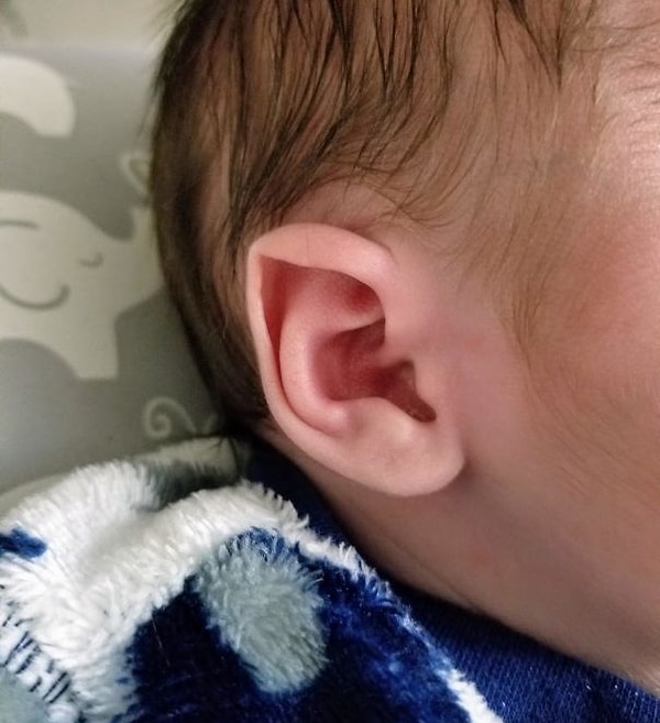 10. "My Son Was Born With Natural Elf Ears"