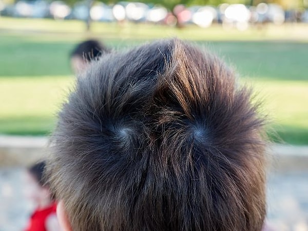 13. My Son Has Symmetrical Hair Whorls Which Go In Opposite Directions. This Allows Him To Grow A Natural Mohawk