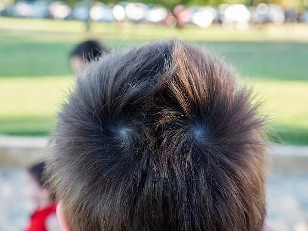 13. My Son Has Symmetrical Hair Whorls Which Go In Opposite Directions. This Allows Him To Grow A Natural Mohawk