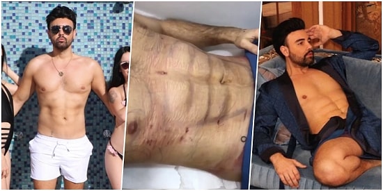 Yaza Doğru Talep Artıyor! Türkiye'nin Dan Bilzerian'ı Taha Özer ile Yeniden Gündeme Gelen 'Karın Kası' Ameliyatı