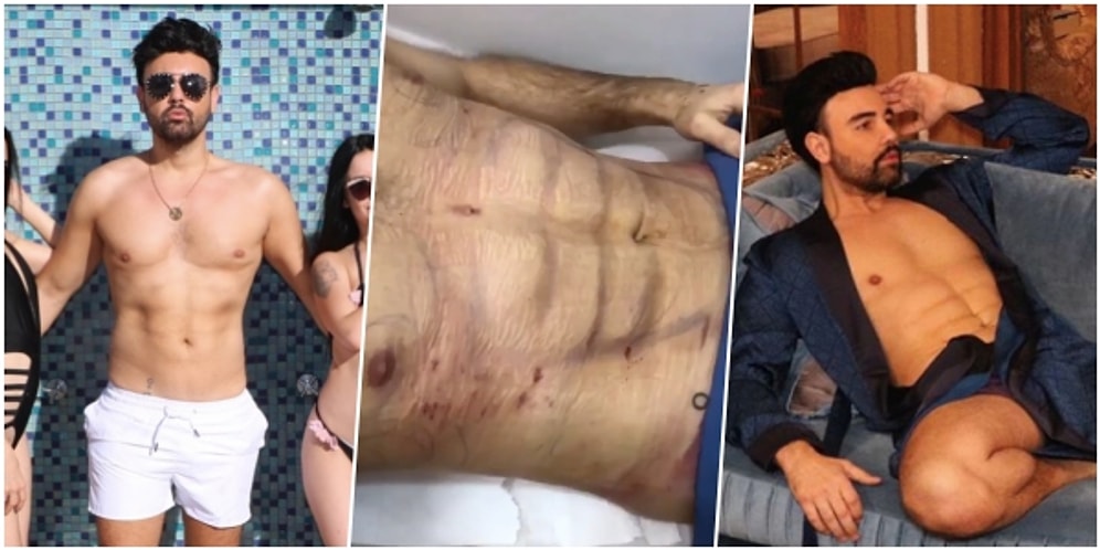 Yaza Doğru Talep Artıyor! Türkiye'nin Dan Bilzerian'ı Taha Özer ile Yeniden Gündeme Gelen 'Karın Kası' Ameliyatı