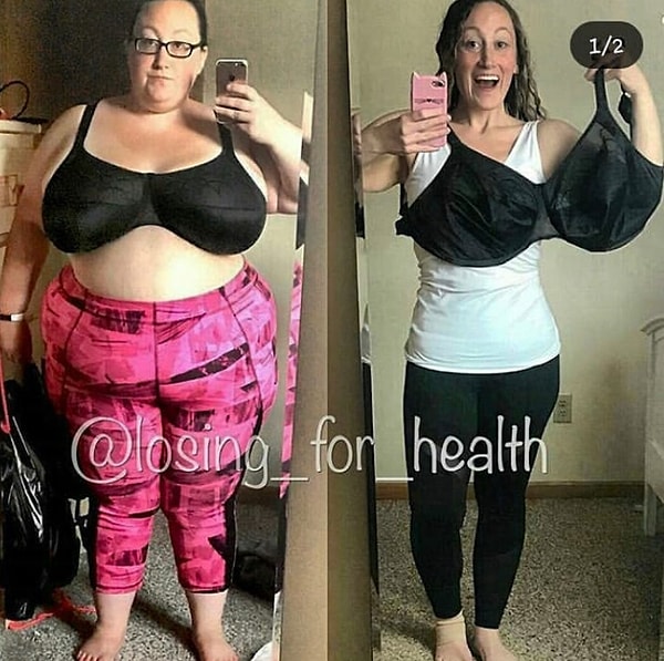 3. Большая грудь - это мечта любой девушки, говорите? Похоже, эта леди наоборот рада, что наконец избавилась от нее!