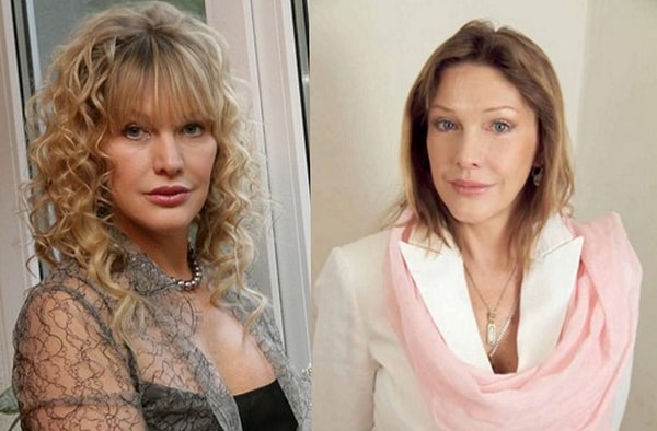 2. Елена Проклова делала бефаропластику, увеличивала губы, изменяла брови