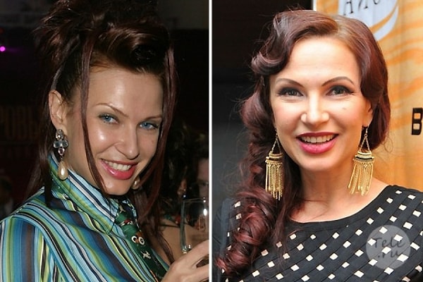 12. Эвелина Бледанс регулярно делает ботокс и не считает это чем-то зазорным