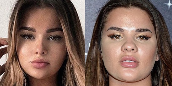 Фальшивая красота: 23 фото "ожидание/реальность" из Инстаграма, на которые без слез не взглянешь