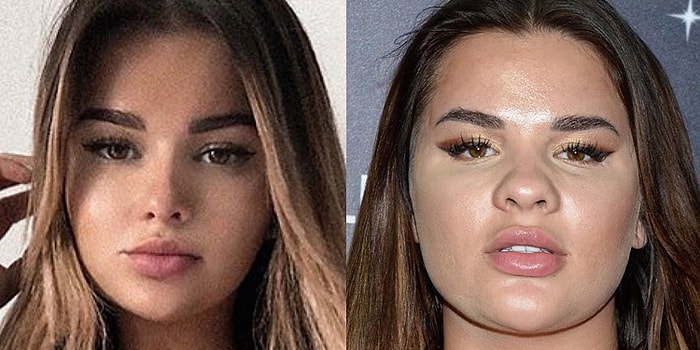 Фальшивая красота: 23 фото "ожидание/реальность" из Инстаграма, на которые без слез не взглянешь