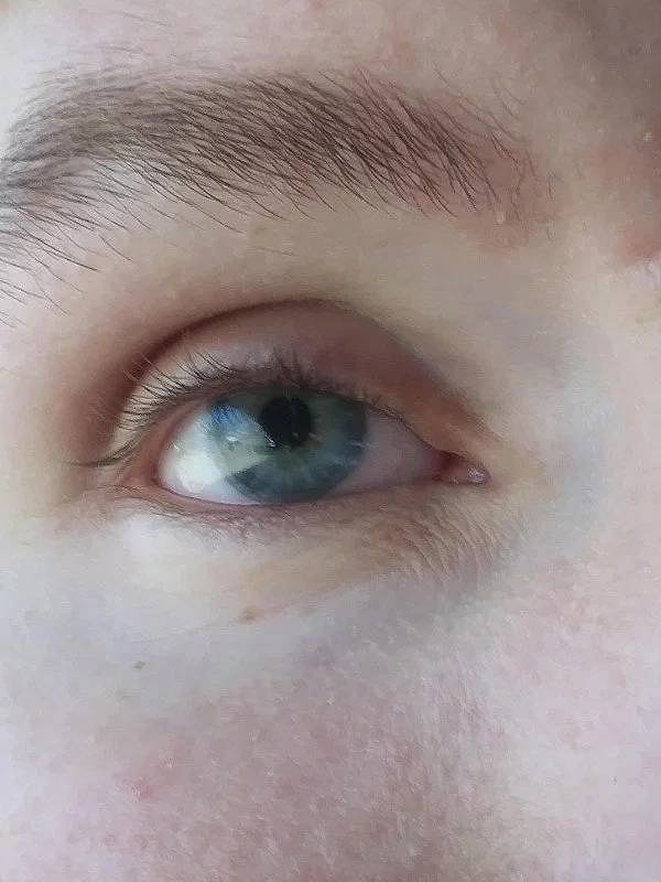 8. "Реалистичность деталей моего протезного глаза впечатляет"