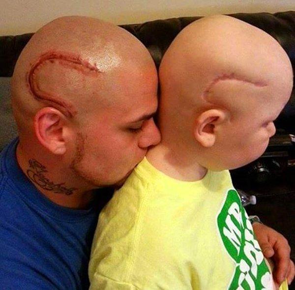 5. Beyin ameliyatı geçiren oğlunun yara izini kendi kafasına dövme yaptıran baba: