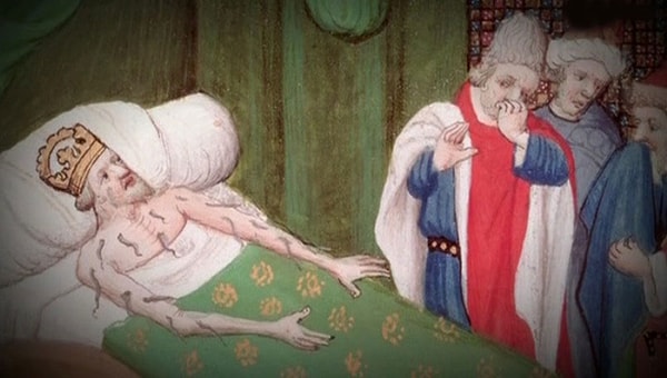 5. Кровопускание