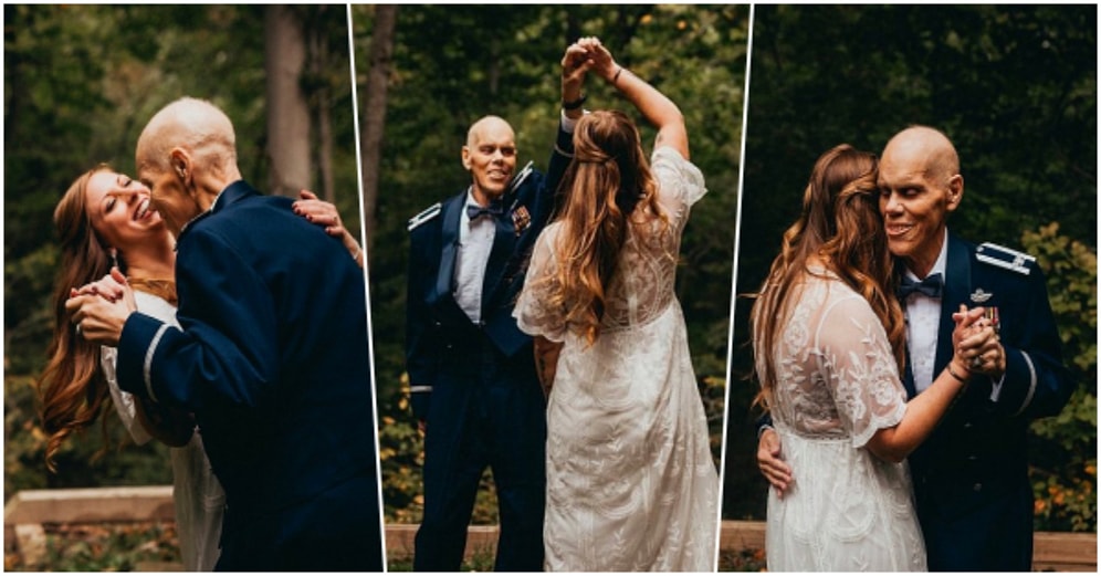 Düğün Fotoğraflarını Nişanlısı Yerine Kanser Hastası Olan Babası İle Çektiren Kadın