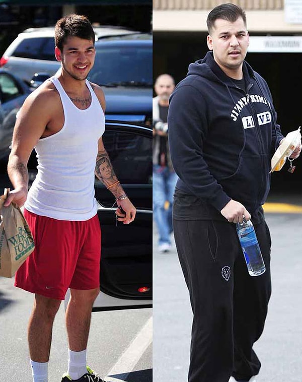 21. Невероятные метаморфозы Роба Кардашяна.