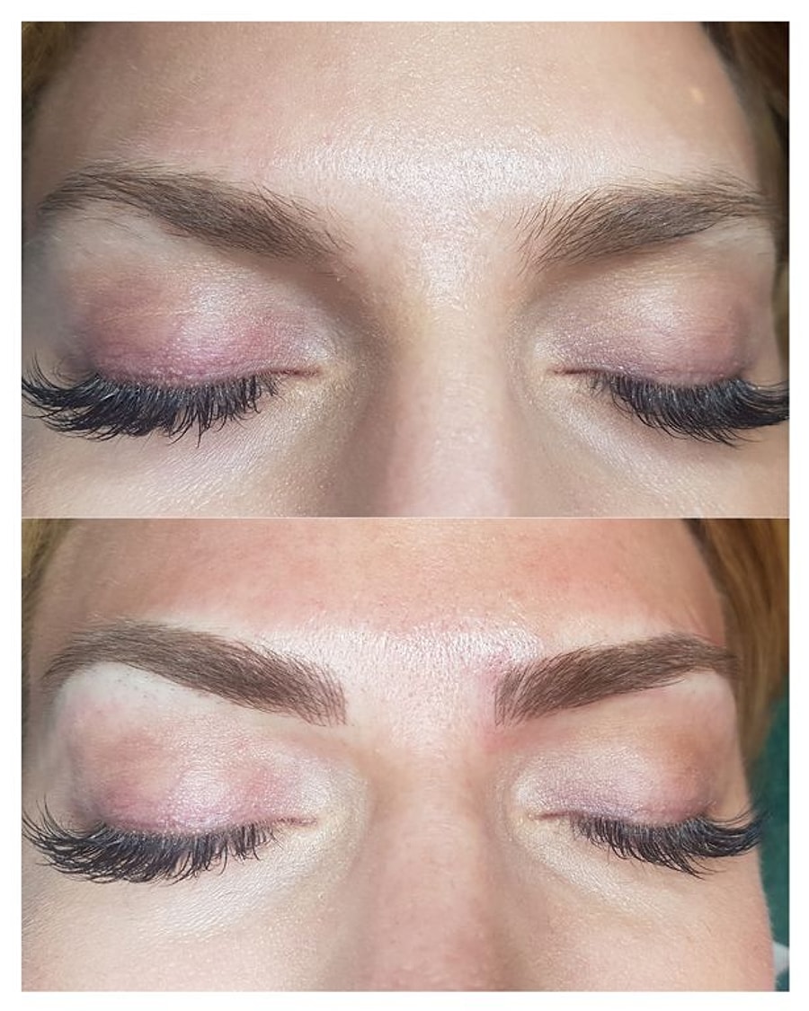 Microblading Sonrasi Kabuklanma Problemi Sosyola