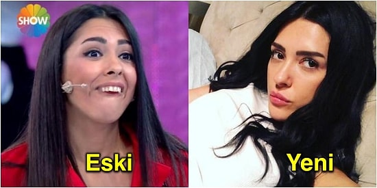 Bu Değişim Değil Yüz Nakli! 'İşte Benim Stilim' Yarışmacısı Ayşegül Doğan'ın Son Hali Sizi Çok Şaşırtacak