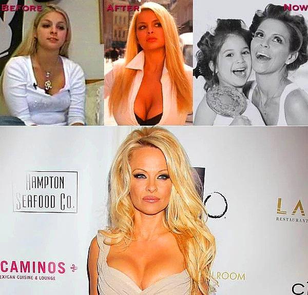 8. Shane Ross, Pamela Anderson'a benzeyebilmek için baya bi' uğraşmış sanki.
