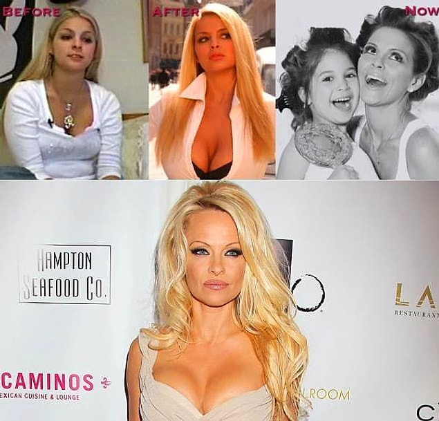 8. Shane Ross, Pamela Anderson'a benzeyebilmek için baya bi' uğraşmış sanki.
