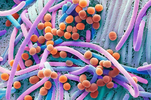 6. Догадались что это?