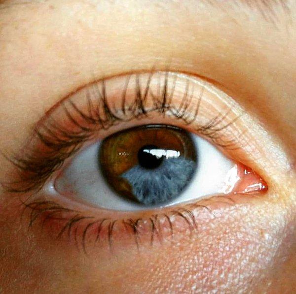 Lazer ışını ile yirmi saniye kadar iris uyarılmakta, sonucunda da koyu göz rengini oluşturan melanin pigmentinin hücreleri terketmesi ve yaklaşık iki üç hafta sonra da irisin giderek mavi renge dönmesi sağlanıyor.