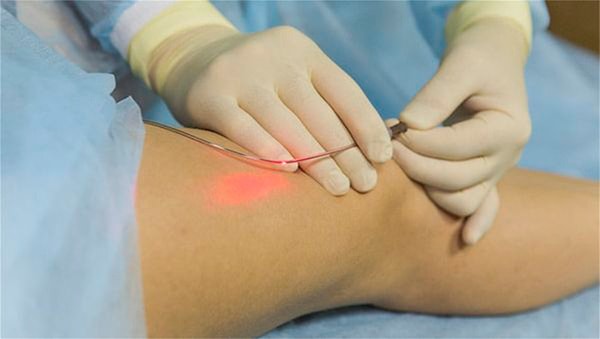 6. Какой из этих врачей лечит вены?