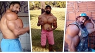 Hayatı Pahasına Devasa Kaslarına Hala Yağ Enjekte Eden Vücut Geliştirici