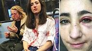Londra'da Bir Otobüste Dört Magandanın Tacizine ve Saldırısına Maruz Kalarak Darp Edilen Lezbiyen Çift
