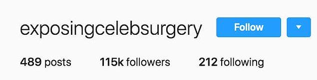 Her şey ünlülerin estetik ameliyatlarını 'ifşa eden' bu Instagram hesabıyla başladı.