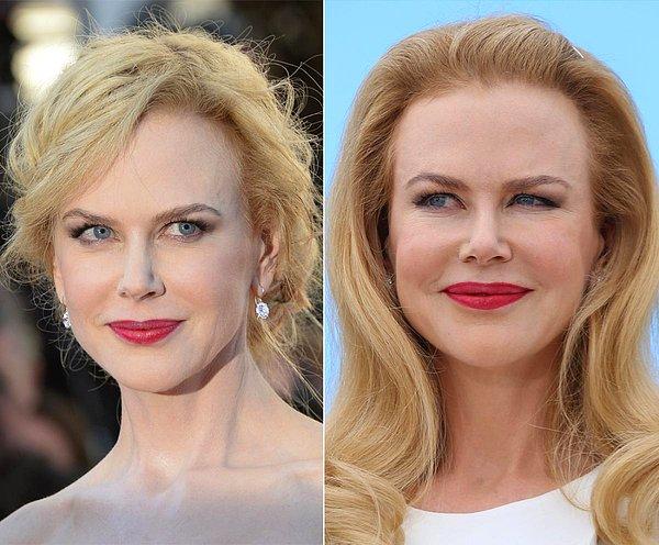 21. Nicole Kidman çok yazık etmiş kendine...