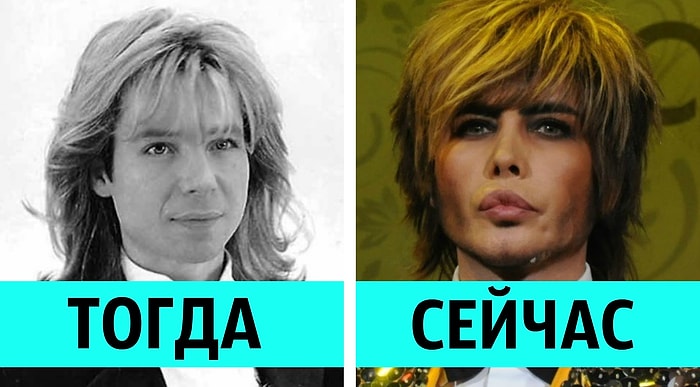 5 отечественных звезд-мужчин, которым нужно уже перестать ходить к пластическим хирургам