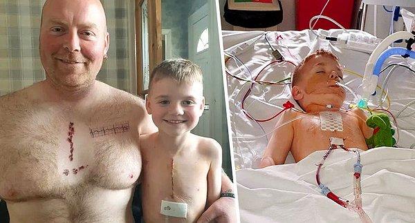 37 yaşındaki Martin Watts, oğlunun geçirdiği son derece riskli açık kalp ameliyatı sonrasında oluşan yara iziyle kendine olan öz güvenini kaybetmesini istemiyordu.