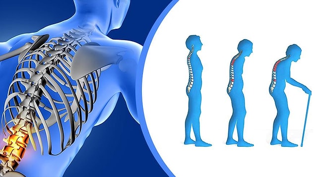 6. Osteoporoz