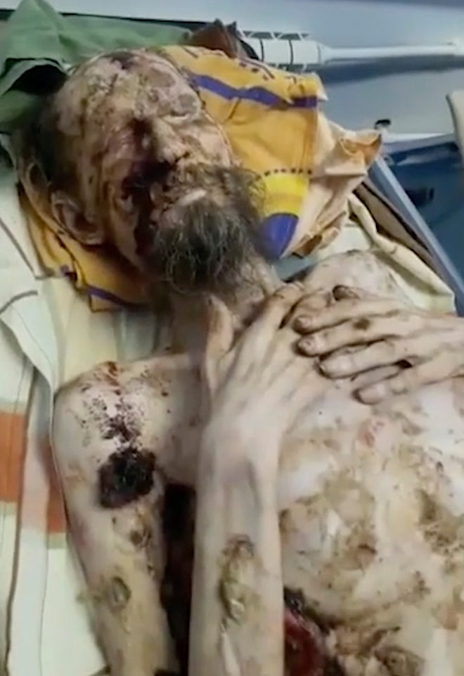 Mumya Sanıldı Canlı Olduğu Ortaya Çıktı