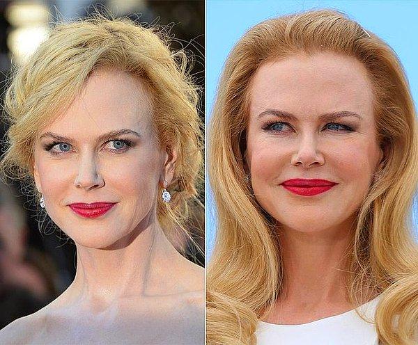 15. Nicole Kidman, "Hiç estetik yaptırmadım" diyenlerden...