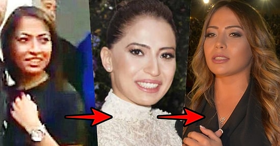 Megastarımız Tarkan'ın Biricik Eşi Pınar Dilek'in Yıllar İçindeki Değişimi Sizi Çok Şaşırtacak!