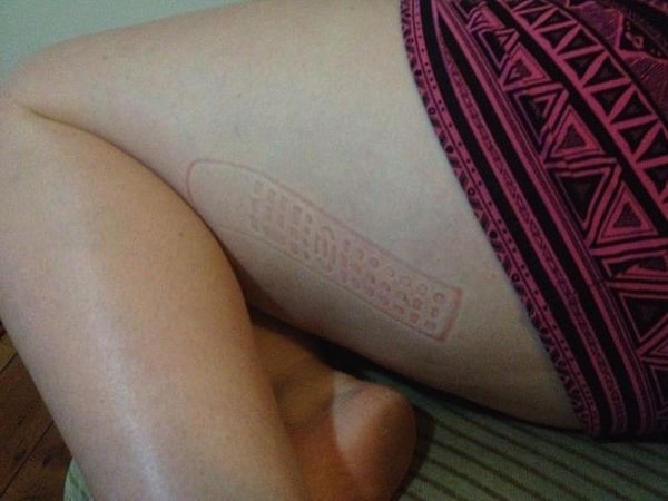 15. «Обнаружил это на бедре моей девушки»