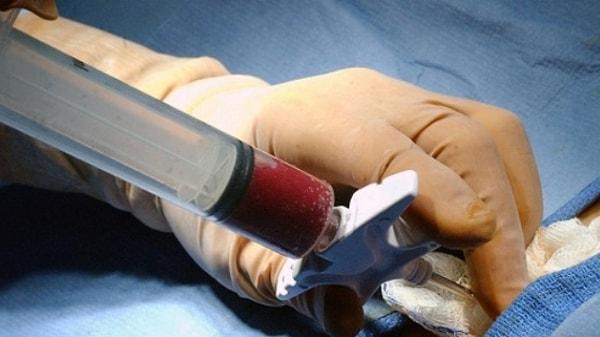 1987 - Türkiye'de kan kanserli bir hastaya ilk kez kemik iliği nakli yapıldı.