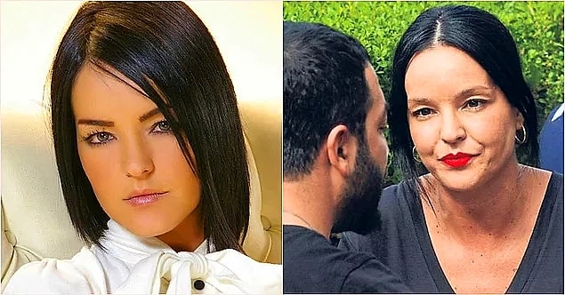 7. Bengü de botoks iddialarını reddedenlerden....