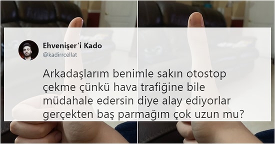 Baş Parmağının Boyu Yüzünden Dalga Konusu Olan Gence Yapılan Yorumlar Herkesi Kahkahalara Boğdu