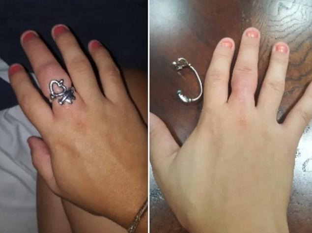 4. "Parmaklarım o kadar şişmişti ki yüzüğü kesip çıkarmak zorunda kaldım."
