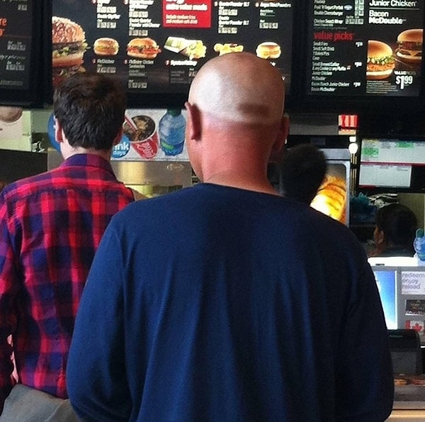 36. Вот что бывает, когда целыми днями носишь кепку