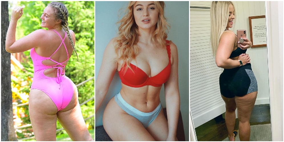 Doğamızın Bir Parçası Olmasına Rağmen Yokmuş Gibi Davranılan Selülitlerini Hiçbir Sakınma Olmadan Paylaşan Kadınlar